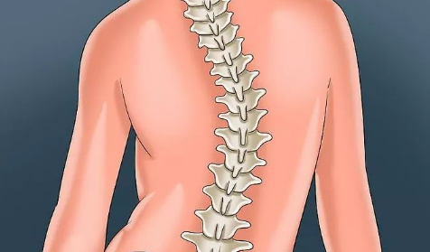 脊柱侧弯的四个自愈动作1